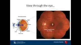 Four Common Ophthalmic Conditions by Douglas Rhee, MD