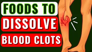 Top 8 Foods That Dissolve Blood Clots Naturally | The Ultimate Guide to Blood Clot Prevention