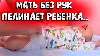 Когда врачи увидели, как мать без рук меняет подгузник сыну, то запретили забирать малыша…