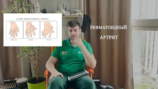 Заболевание ревматоидный артрит! Как лечить?