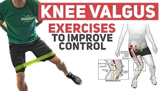 Knee Valgus - Rehab Exercises to Improve Movement Control