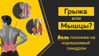 Боль в спине, отдает в ногу. Как не спутать грыжу с болью в мышцах? Техники и приемы.