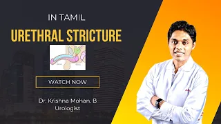 This episode we discuss about urethral strictures and it’s treatment in Tamil by Dr. Krishna Mohan