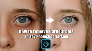 Remove Deep Dark Circles Flawlessly || Any Photoshop Version ! ||