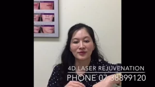 4D Laser Face Lifting and Tightening Procedure explained