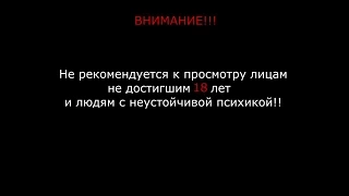 Человеческая многоножка