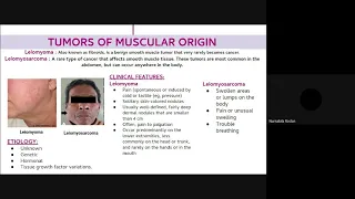 Differential Diagnoses of unilateral facial swelling