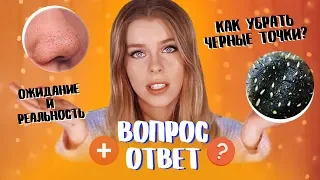 КАК ИЗБАВИТЬСЯ ОТ ЧЕРНЫХ ТОЧЕК?? ВОПРОС - ОТВЕТ/ Ира Блан