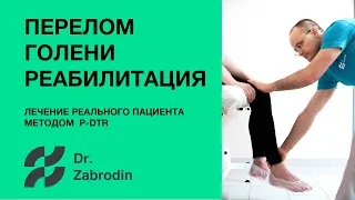 Fracture of the lower leg out of the blue. Reasons.  Rehabilitation.  PDTR Method