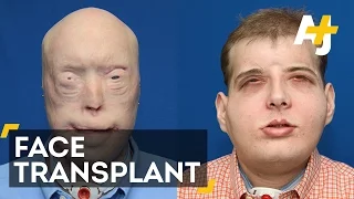 Firefighter Undergoes Extensive Face Transplant At NYC Hospital