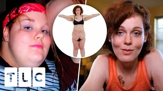 Mother Loses 339 Lb To Make Her Child Proud | My Extreme Excess Skin