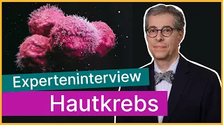 Hautkrebs erkennen und behandeln | Asklepios