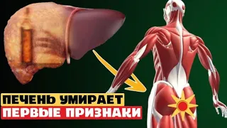 Самые ВАЖНЫЕ признаки того, что ваша ПЕЧЕНЬ медленно ОТМИРАЕТ! 99% даже НЕ догадываются...