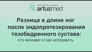 Разница в длине ног после эндопротезирования тазобедренного сустава: кто виноват и как исправить