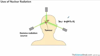 Uses of Radiation Medical for AQA 9-1 GCSE Physics (Separate Science)