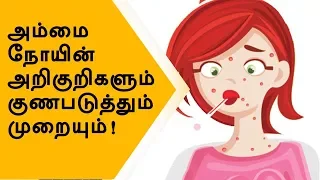 chicken pox symptoms causes and prevention | Health Tips, Ayur veda | Parambariyam