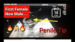 First Female GENDER l Now Male GENDER🔥👼🔥 on Ultrasound l