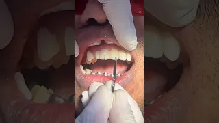 Quando seu Cartão é Recusado no Dentista…E se Acontece com Você? #shorts