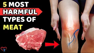 Watch Out! 5 Types Of Meat Causing Blood Circulation Blockage | Vitality Solutions
