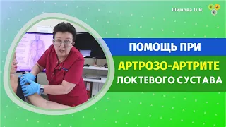 ПОМОЩЬ ПРИ АРТРОЗО-АРТРИТЕ ЛОКТЕВОГО СУСТАВА. [Шишова О И.]