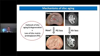 Effects of rapamycin on age-associated intervertebral disc degeneration