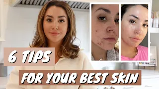 6 WAYS TO GET BEST SKIN OF YOUR LIFE | SKINCARE ROUTINE