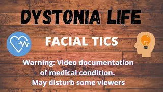 Facial tics of dystonia