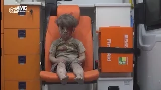 Выживший после авиаудара мальчик стал символом войны в Сирии