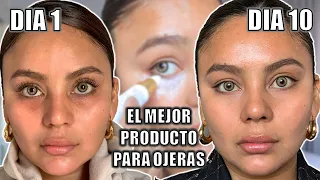 ELIMINO OJERAS EN 10 DIAS LA CREMA #1 DEL MUNDO DEMARTOLOGICO