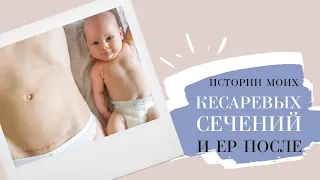 ЕР ПОСЛЕ КС | Мои истории родов 🌿