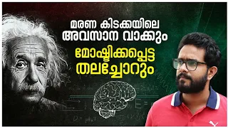 അവസാനമായി പറഞ്ഞ വാക്കുകളും മോഷ്ടിക്കപ്പെട്ട തലച്ചോറും ! Untold Story of Albert Einstein In Malayalam