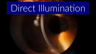 Direct Illumination - Slit Lamp Techniques