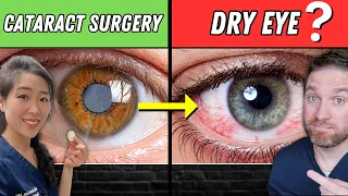 Dry Eyes After Cataract Surgery? (Causes And Tips To Help)