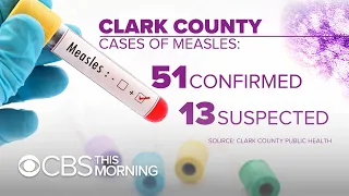 Washington state weighs vaccination bill amid "critical" measles outbreak