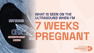 Week 7 Pregnant Ultrasound: Baby's Heartbeat & Growth Shown!