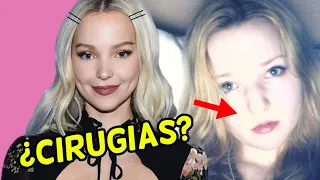 Las Cirugías que se a hecho DOVE CAMERON (Antes y Después)