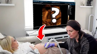 SEEING OUR BABY GIRL FOR THE FIRST TIME ON 4D/5D ULTRASOUND!*EMOTIONAL*