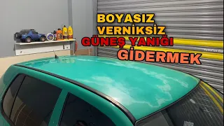 BOYASIZ | VERNİKSİZ | GÜNEŞ YANIKLARINI GİDERMEK | DETAYLI