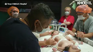 Parents hold conjoined twin boys before surgery at TCH in Houston