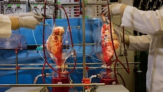 Watch: Pig Lungs Filter Human Blood in a Lab | National Geographic