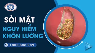 SỎI MẬT - MỐI NGUY HIỂM KHÔN LƯỜNG