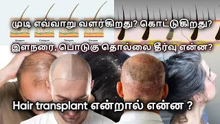 Hair Loss Hair Grows Explained in Tamil | Stop Hair Fall & Dandruff | Hair Transplantation