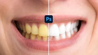 How To Whiten Yellow Teeth In Photoshop | #Photoshop | #Editing_World | #photoshoptricks | #shorts