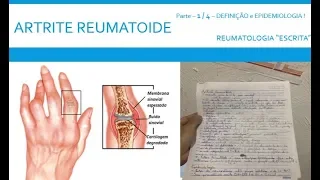 AULA 17 - Artrite Reumatoide (Pt.1) - Definição e Epidemiologia - [Reumatologia escrita]