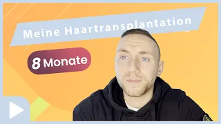 Haartransplantation Türkei - 8 Monate später