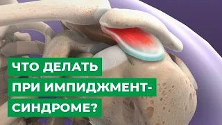 Что делать при импиджмент-синдроме?