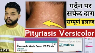 गर्दन पर सफेद दाग धब्बे का इलाज | Pityriasis Versicolor Causes, Symptoms And Treatment