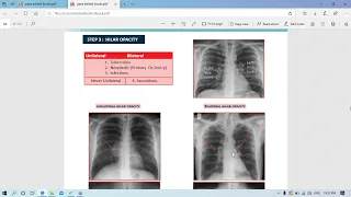 Radiology - 2 chest x-ray - Dr Mahmoud Allam