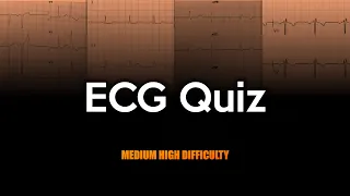 ECG Quiz: Medium to High Difficulty