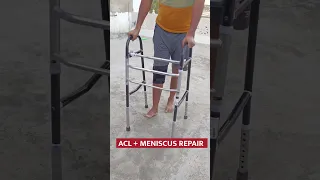 Walking after ACL ligament and meniscus repair surgery #shorts #health #short  #aclrecovery